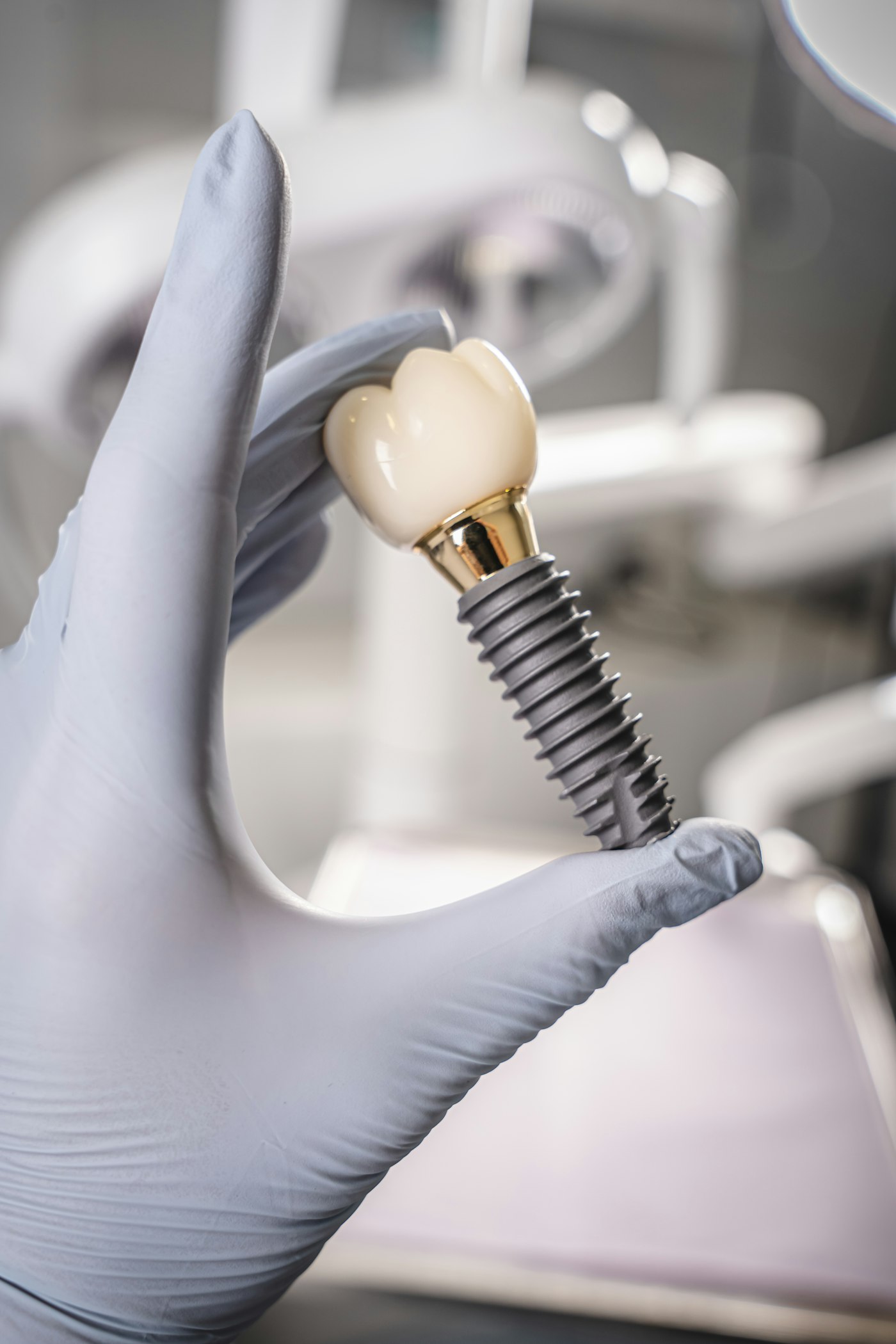 Gloved hand holding a dental implant with its crown attached